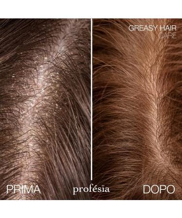  Profesia Shampoo for oily hair 300 ml mild shampoo professional rebalancing shampoo oily hair anti-sebum and anti-grease treatment seboregulating shampoo - Buy Online on GoSupps.com
