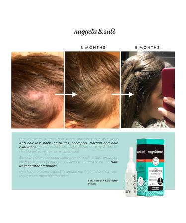 Nuggela & Sul Regenerating Ampoules - Boost Hair Density & Thickness | 4 x 10ml Treatment for Thinning Areas - 4 Week Supply - Buy Online on GoSupps.com