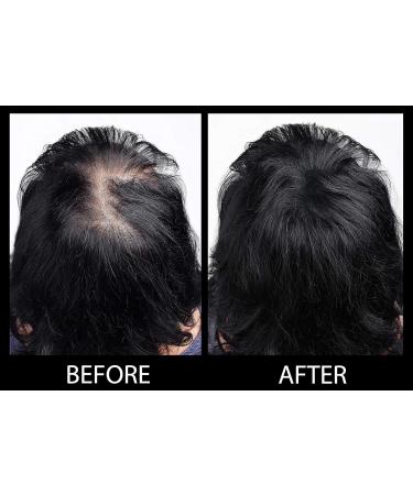 MAXX PRO Series Volumizing Hair Fibers with Real Keratin | Hypoallergenic & Dermatologist Tested | 60 Days Supply for Hair Loss (Gray) - Buy Online on GoSupps.com
