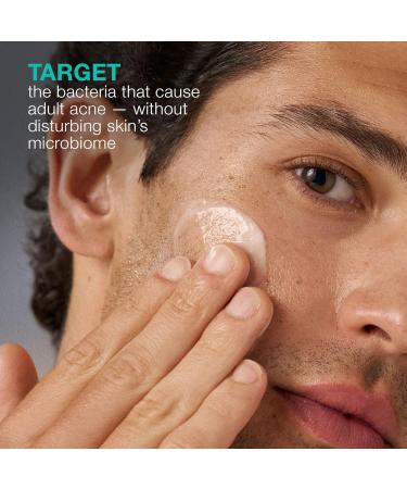 Dermalogica Acne Biotic Face Moisturizer Lightweight Daily Lotion - Helps with Aging Skin and Prevents Breakouts 1.7 fl oz - Buy Online on GoSupps.com