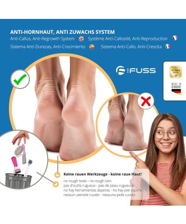 Horn Skin Remover Mr. Fuss No.4 - 250ml | Fast Relief for Calluses Corns Cuticles & Pressure Points | Immediate Results in 10 Minutes - International Shipping Available - Buy Online on GoSupps.com