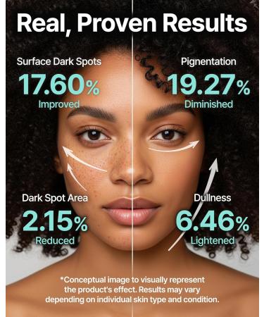 Charde Niacinamide Brightening Serum for Dark Spots & Uneven Tone | Radiance Boosting with White Garcinia & Arbutin, Korean Skincare, 1.01 fl oz - Buy Online on GoSupps.com