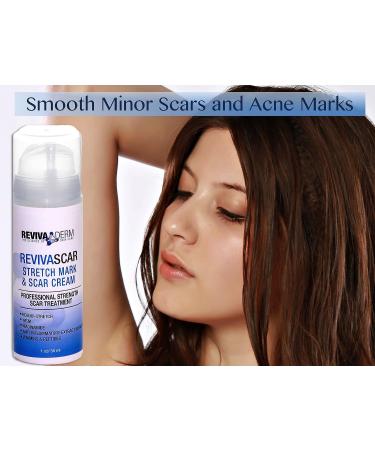 Revivaderm RevivaScar Stretch Mark & Scar Cream - Professional Strength Treatment for Stretch Marks, Acne Scars & Renewal - 1oz - Buy Online on GoSupps.com