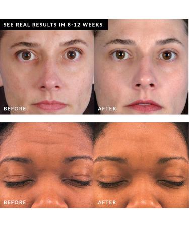 PMD Beauty Personal Microderm Pro - Black 400g | Exfoliate & Rejuvenate Skin - International Shipping Available - Buy Online on GoSupps.com