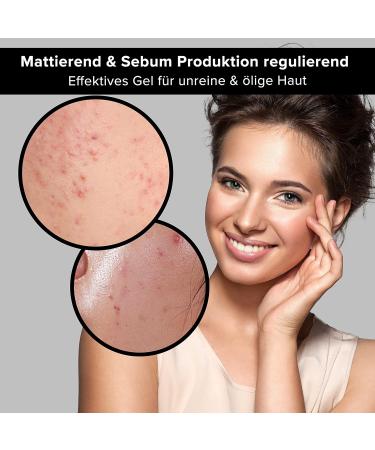 RAU Balancing & Mattifying Face Gel with BHA - Oily Skin Care for Pimples & Blackheads - 2.54 FL oz - Effective Night Treatment for Blemishes - Buy Online on GoSupps.com