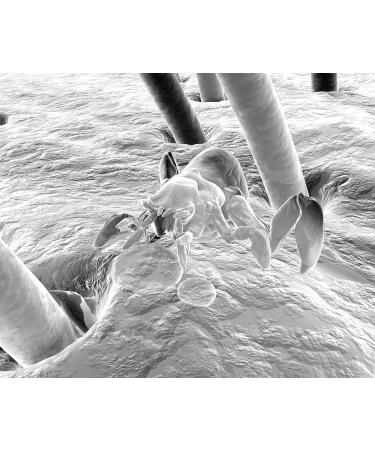 Ynsadiet Aya Anti-Lice Shampoo 150ml - Buy Online on GoSupps.com