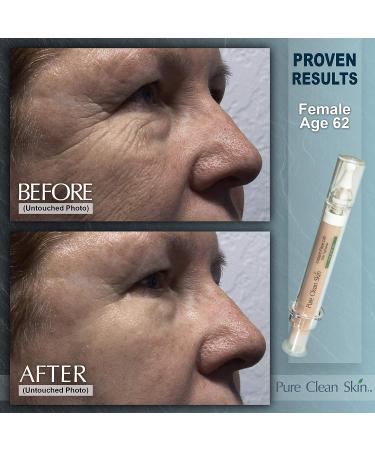 EUZEN Skin Tightening Cream: Instant Face Lift, Reduce Wrinkles & Fine Lines - Buy Online on GoSupps.com