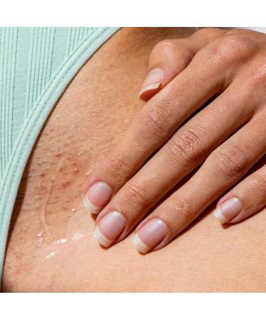 WildMint Spot Soothe Natural Spot Treatment Gel | Reduces Breakouts Scars & Irritation | Tea Tree Healing Serum for Acne Prone Skin Blemishes Redness & Ingrown Hairs | Cruelty-Free UK Skincare 30ml - Buy Online on GoSupps.com