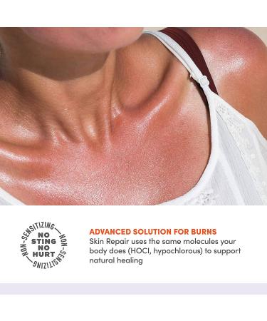 Active Skin Repair First Aid Burn Hydrogel - Natural Non-Toxic Gel for Immediate Pain Relief - 3 oz - Buy Online on GoSupps.com