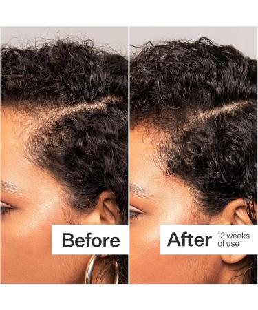 ACT+ ACRE Thick + Full Hair Capsules | Supplement for Thicker Fuller Looking Hair | Bamboo Horsetail Biotin Vitamin C | Strengthens Roots Vegan Gluten-Free Mint Essenced | 60ct - Buy Online on GoSupps.com