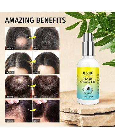 Luv Me Care Hair Growth Oil 2 Pack - Biotin & Castor Oil Serum for Stronger, Thicker, Longer Hair 1.7 oz - Buy Online on GoSupps.com