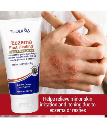 TriDerma Eczema Cream | Fast Healing Relief for Face and Body | 6.0 oz Tube - Buy Online on GoSupps.com