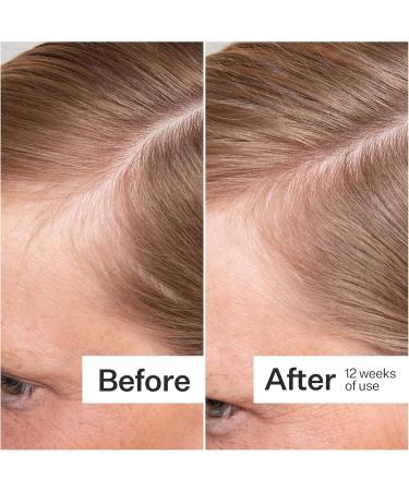 ACT+ ACRE Thick + Full Hair Capsules | Supplement for Thicker Fuller Looking Hair | Bamboo Horsetail Biotin Vitamin C | Strengthens Roots Vegan Gluten-Free Mint Essenced | 60ct - Buy Online on GoSupps.com