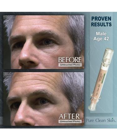EUZEN Skin Tightening Cream: Instant Face Lift, Reduce Wrinkles & Fine Lines - Buy Online on GoSupps.com