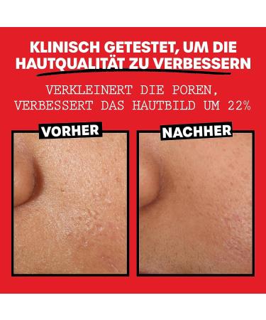 Thayer's Organic Aloe Vera Facial Toner - Alcohol-Free Vegan 98% Natural - Radiance & Pore Reduction - 355 ml - Buy Online on GoSupps.com