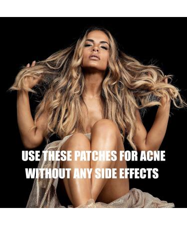 Medical Miracles Acne Healing Patches - Chlorophyll Tea Tree Oil Hydrocolloid - 72 Ultra Healing Face Treatments for Zits Pimples & Blemishes - Buy Online on GoSupps.com