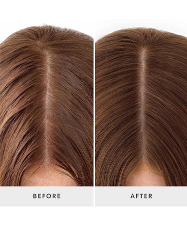 Buy Drybar Detox Gentle Dry Shampoo for Sensitive Scalp | Best Dry Shampoo for International Shipping - Buy Online on GoSupps.com