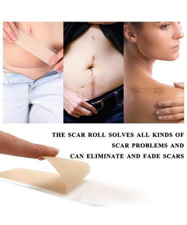 Medical Grade Silicone Scar Sheets - Reusable Scar Tape for C-Section, Surgery, Burn, Keloid - 1.6x120 - Buy Online on GoSupps.com
