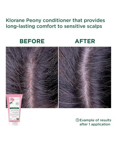 Klorane Peony Soothing Conditioner for Sensitive Scalp - 150ml | International Shipping Available - Buy Online on GoSupps.com