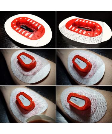 Infiniflex for Dexcom G6 Reusable Flexible Transmitter Adhesive Cover Guard by Freedom Bands (Pink) - Buy Online on GoSupps.com