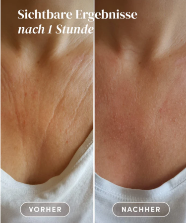 Apricot Beauty Dekoltee Pad with Hyaluronic Acid | Anti-Wrinkle Silicone Patch for Tightening | Libert D collet | Dermatologist Approved | Made in Germany | 30 Applications - Buy Online on GoSupps.com