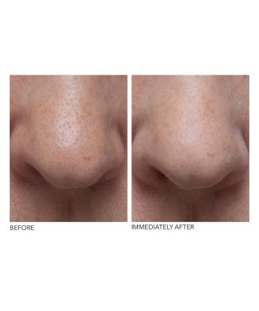 Shop Dr. Dennis Gross Skincare DRx Blemish Solutions Clarifying Mask with Colloidal Sulfur Online - Best Price & International Shipping - Buy Online on GoSupps.com