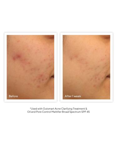Shop Murad Acne Control Clarifying Cleanser - 6.75 oz Online - Best Price & International Shipping - Buy Online on GoSupps.com