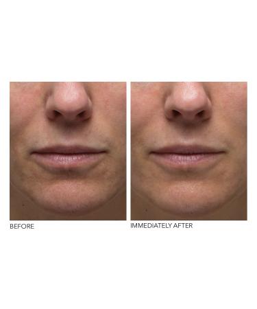 Shop Dr. Dennis Gross Skincare Hyaluronic Marine Hydrating Modeling Mask - 4 treatments Online - Best Price & International Shipping - Buy Online on GoSupps.com