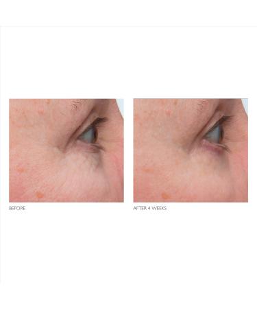 Shop Kate Somerville Retinol Firming Eye Cream - 0.5 oz/ 15 mL Online - Best Price & International Shipping - Buy Online on GoSupps.com