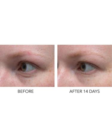 Shop Dr. Dennis Gross Skincare Hyaluronic Marine Dew It Right Eye Gel - 0.5 oz/ 15 mL Online - Best Price & International Shipping - Buy Online on GoSupps.com