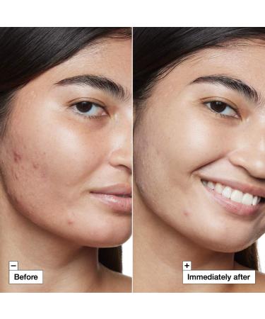 Shop Dr. Jart+ Cicapair Tiger Grass Camo Drops Color Corrector SPF 35 - 1 oz/ 30 mL Online - Best Price & International Shipping - Buy Online on GoSupps.com