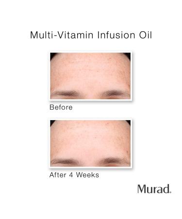 Shop Murad Multi-Vitamin Infusion Oil - 1 oz/ 30 mL Online - Best Price & International Shipping - Buy Online on GoSupps.com