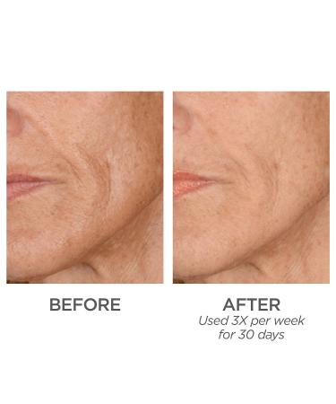 Shop BeautyBio GloPRO FACE MicroTip Attachment Head -White/Off-white Online - Best Price & International Shipping - Buy Online on GoSupps.com