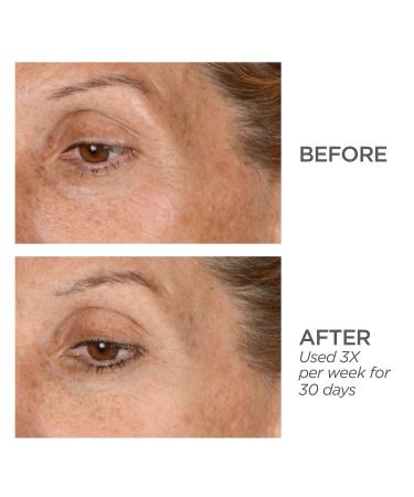 Shop BeautyBio GloPRO EYE MicroTip Attachment Head -White/Off-white Online - Best Price & International Shipping - Buy Online on GoSupps.com