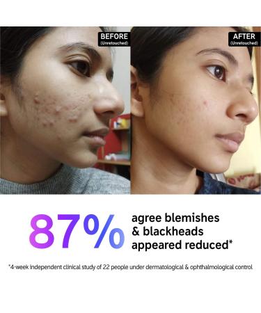 Shop The INKEY List Salicylic Acid Acne + Blackhead Cleanser - 5 oz/ 150 mL Online - Best Price & International Shipping - Buy Online on GoSupps.com