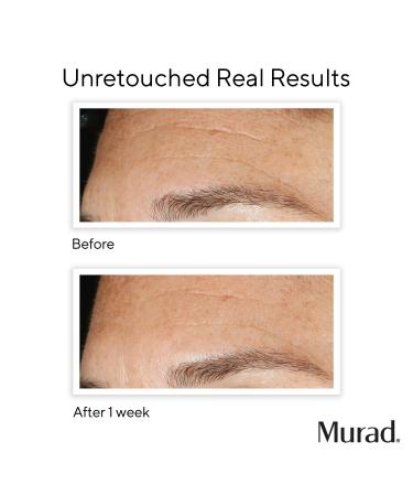 Shop Murad Replenishing Multi-Acid Peel - 3.3 oz/ 100 mL Online - Best Price & International Shipping - Buy Online on GoSupps.com