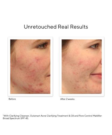 Shop Murad Oil and Pore Control Mattifying Face Sunscreen SPF 45 PA++++ - 1.7 oz/ 50 mL Online - Best Price & International Shipping - Buy Online on GoSupps.com