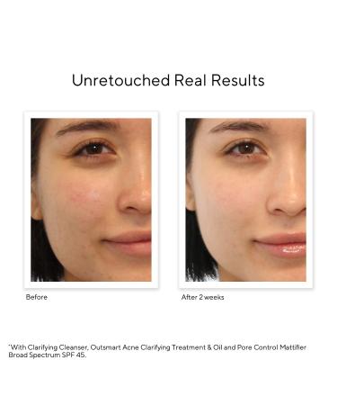 Shop Murad Oil and Pore Control Mattifying Face Sunscreen SPF 45 PA++++ - 1.7 oz/ 50 mL Online - Best Price & International Shipping - Buy Online on GoSupps.com