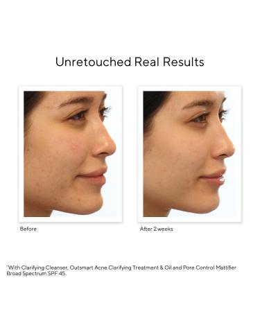 Shop Murad Oil and Pore Control Mattifying Face Sunscreen SPF 45 PA++++ - 1.7 oz/ 50 mL Online - Best Price & International Shipping - Buy Online on GoSupps.com