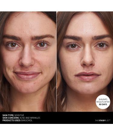Shop The INKEY List Bakuchiol Retinol Alternative Moisturizer - 1 oz/ 30 mL Online - Best Price & International Shipping - Buy Online on GoSupps.com
