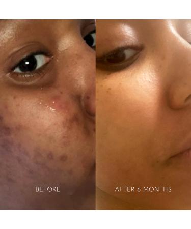 Shop Dr. Barbara Sturm Clarifying Mask - 1.69 oz/ 50 mL Online - Best Price & International Shipping - Buy Online on GoSupps.com