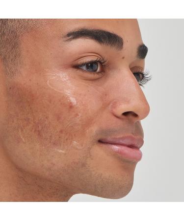 Shop The INKEY List Tranexamic Acid Hyperpigmentation Treatment - 1 oz/ 30 mL Online - Best Price & International Shipping - Buy Online on GoSupps.com