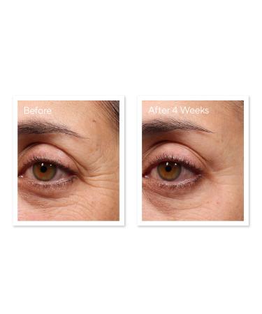 Shop Murad Retinol Youth Renewal Eye Serum - 0.5 oz/ 15 mL Online - Best Price & International Shipping - Buy Online on GoSupps.com