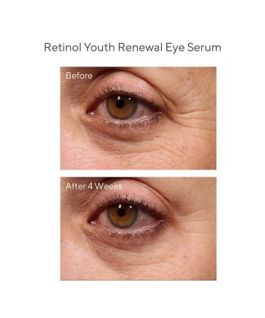 Shop Murad Youth Renewal Retinol Trial Kit for Smoother Younger-Looking Skin Online - Best Price & International Shipping - Buy Online on GoSupps.com