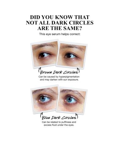 Shop Kiehl's Since 1851 Powerful-Strength Dark Circle Reducing Vitamin C Eye Serum - 0.5 oz / 15 mL Online - Best Price & International Shipping - Buy Online on GoSupps.com