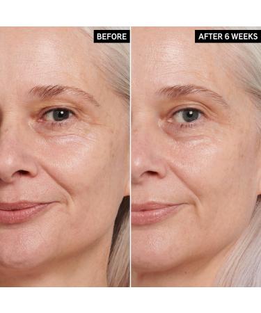 Shop The INKEY List Retinol Eye Cream - 0.5 oz/ 15 mL Online - Best Price & International Shipping - Buy Online on GoSupps.com