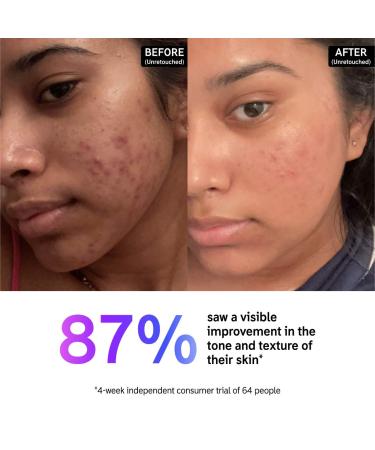 Shop The INKEY List 15% Vitamin C & EGF Brightening Serum - 1 oz/ 30 mL Online - Best Price & International Shipping - Buy Online on GoSupps.com