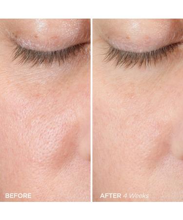 Shop BeautyBio The ZenBubble Oil-Free Calming Gel Cream with Soothing Cica & Marine Actives - 1.7 oz/ 50 mL Online - Best Price & International Shipping - Buy Online on GoSupps.com