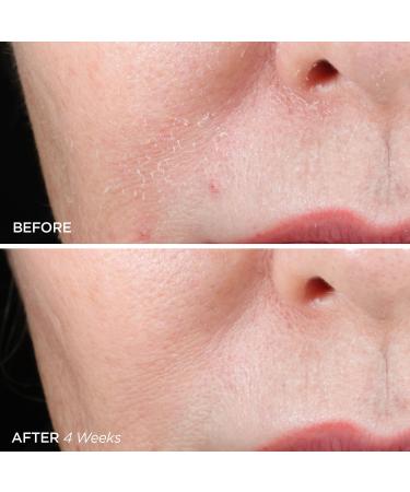 Shop BeautyBio The ZenBubble Oil-Free Calming Gel Cream with Soothing Cica & Marine Actives - 1.7 oz/ 50 mL Online - Best Price & International Shipping - Buy Online on GoSupps.com