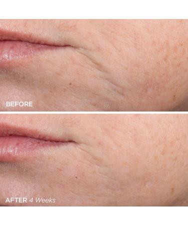 Shop BeautyBio The ZenBubble Oil-Free Calming Gel Cream with Soothing Cica & Marine Actives - 1.7 oz/ 50 mL Online - Best Price & International Shipping - Buy Online on GoSupps.com